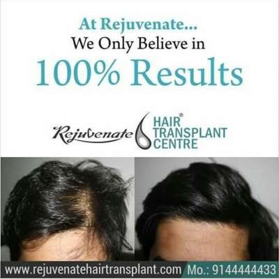 BEST HAIR TRANSPLANT FOR MEN AND WOMEN IN INDIA