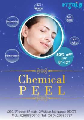 Treat your acne scars with chemical peels