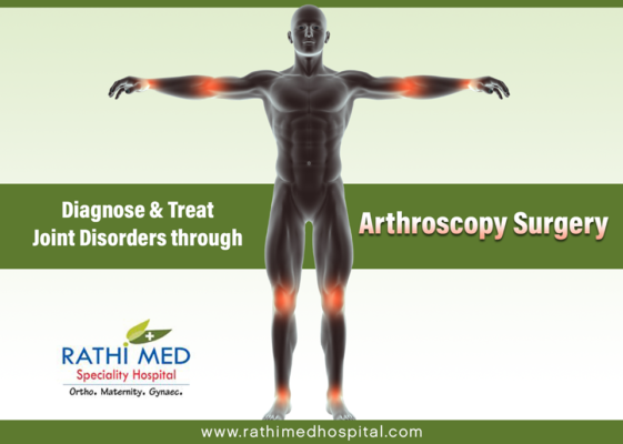 Best Knee Arthroscopy in Chennai