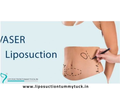 Remove Unwanted Fat Through Vaser Liposuction