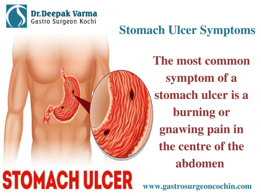 Get Effective Treatment for Ulcers