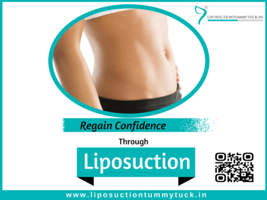 Shape Your Body With Liposuction