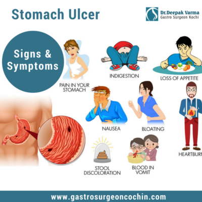 Get Effective Treatment for Ulcers - SC Classifieds