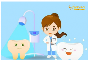Best Tooth Whitening Procedure in Chennai