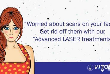 Remove Acne Scars With Laser Treatment