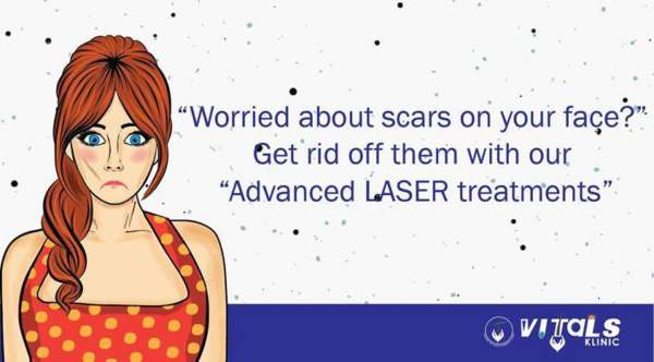 Remove Acne Scars With Laser Treatment