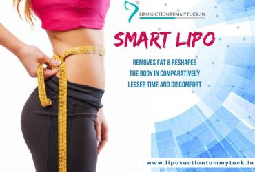 Reshape Your Body Through SmartLipo