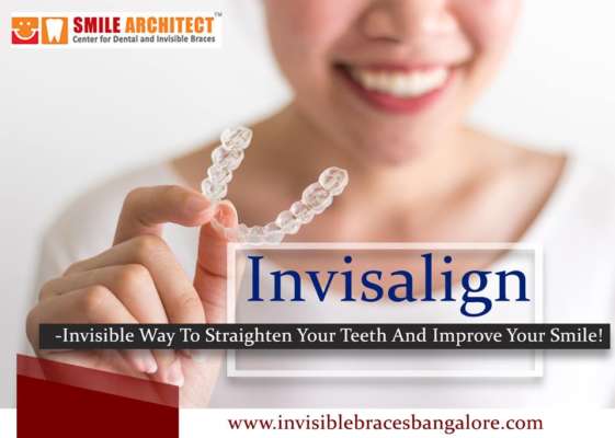 Straighten Your Teeth with Invisalign