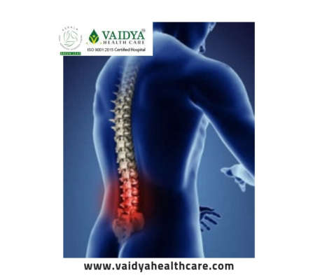 Get Ayurveda Treatment For Prolapsed Disc