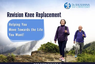 Knee Replacement Surgery in Chennai