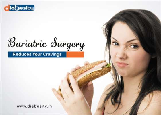 Shed Those Extra Pounds With Bariatric Surgery!