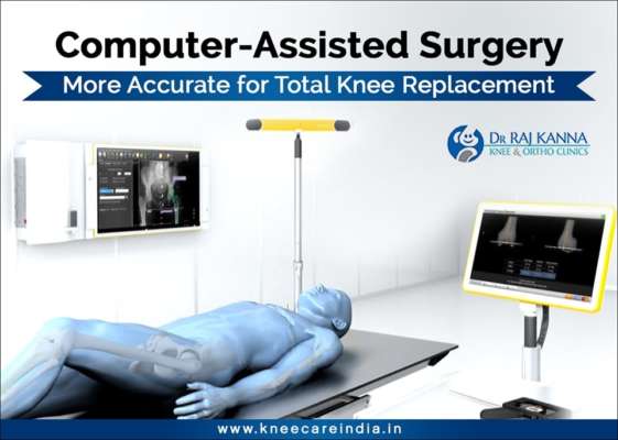 Cost Effective Computer Assisted Knee Replacement