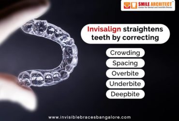 Effective Solution for Miss Aligned Teeth