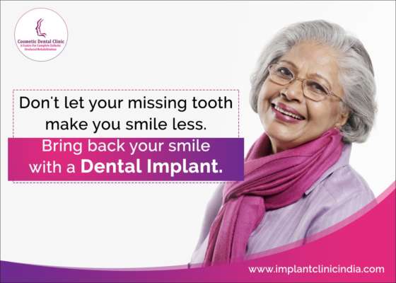 Replace Your Missing Teeth With Dental Implants