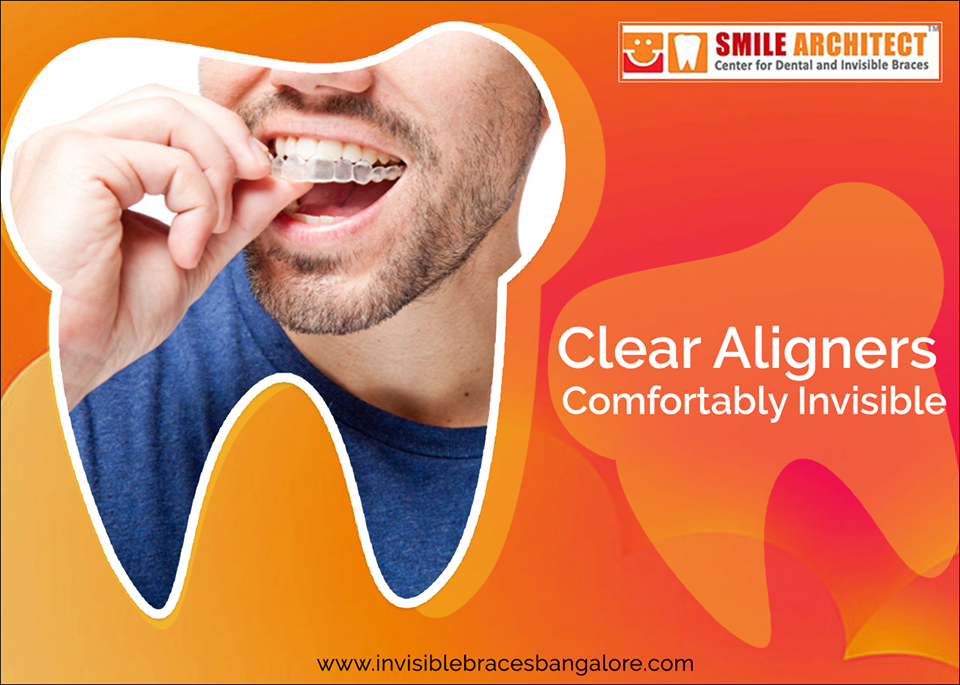 A Better And Clear Way To Straighten Teeth | Invisalign