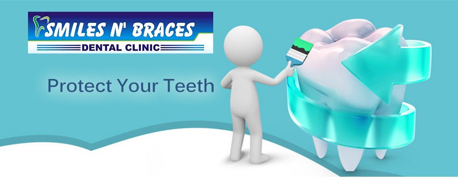 Braces in Lucknow | Dentist in Aliganj | Orthodontist in Lucknow