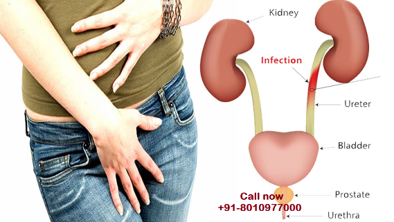 Urine infection doctor in Moti Bagh – 8010977000