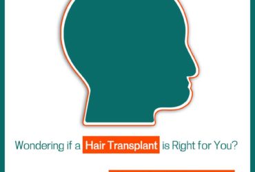 Best Hair Transplant in Punjab