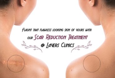 Best Comprehensive & Painless Scar Reduction Treatment in Hyderabad