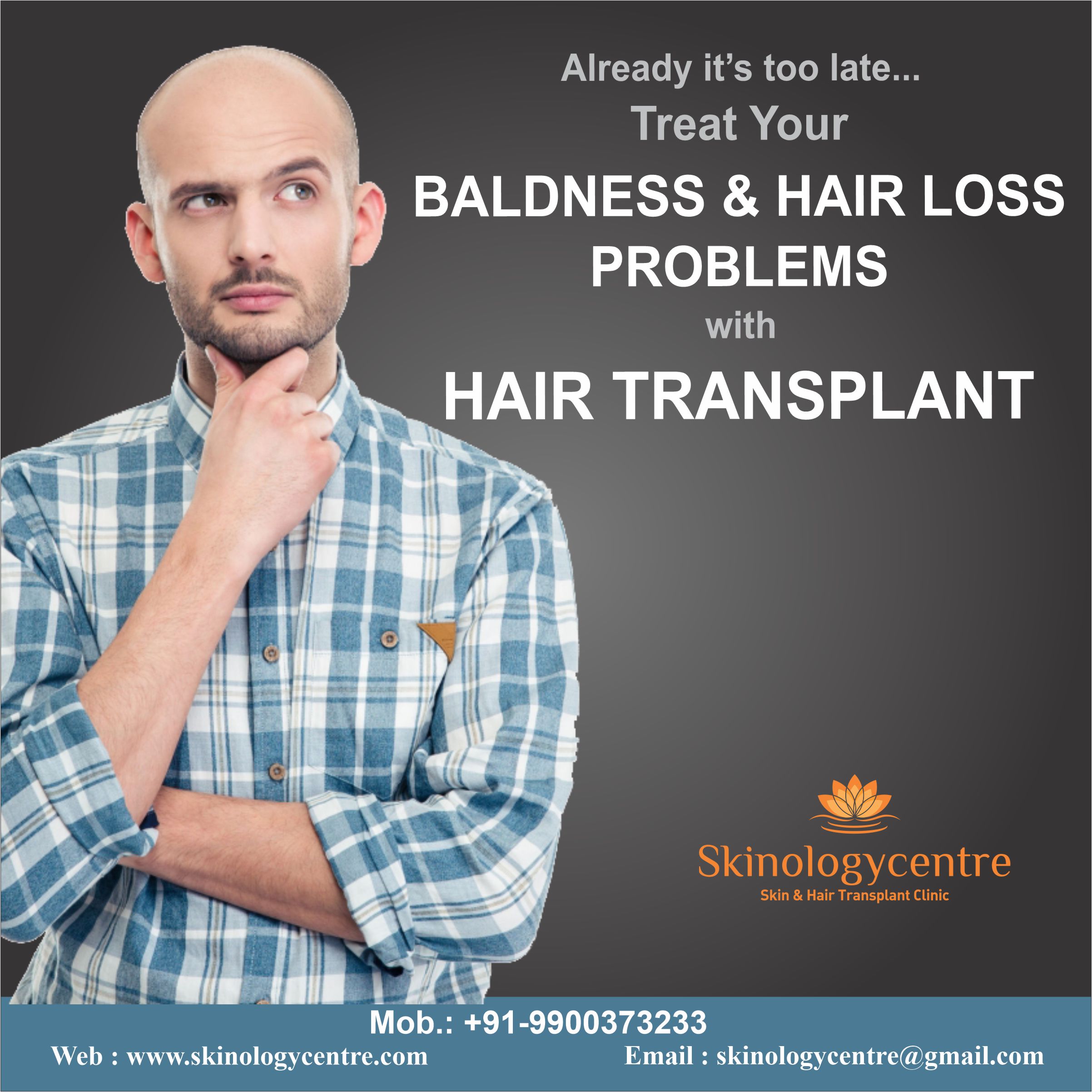 Hair Transplant Cost in Bangalore | FUE Hair Transplant @ Rs.29,999/