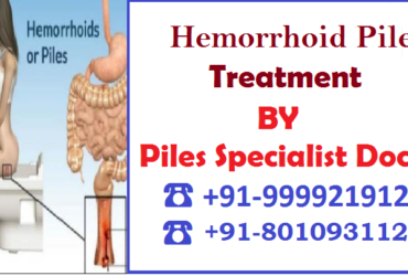 Hemorrhoids piles treatment in Amar Colony :: 8010931122