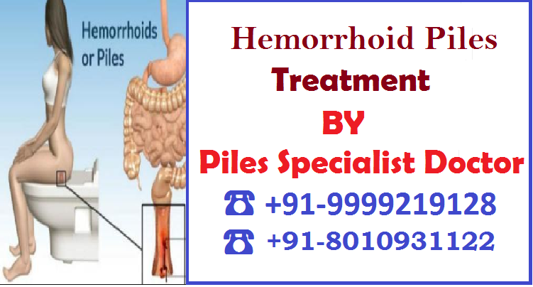 Hemorrhoids piles treatment in Amar Colony :: 8010931122