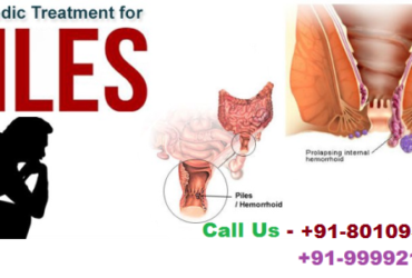 Call @ 801093112 | Best ayurvedic doctor for piles in Bhagwan Nagar