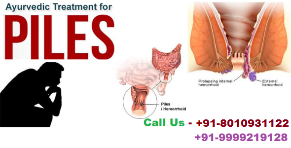 Call @ 801093112 | Best ayurvedic doctor for piles in Bhagwan Nagar