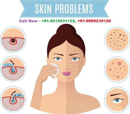 Lady Skin Specialist doctor in Uttam Nagar West :: 8010931122