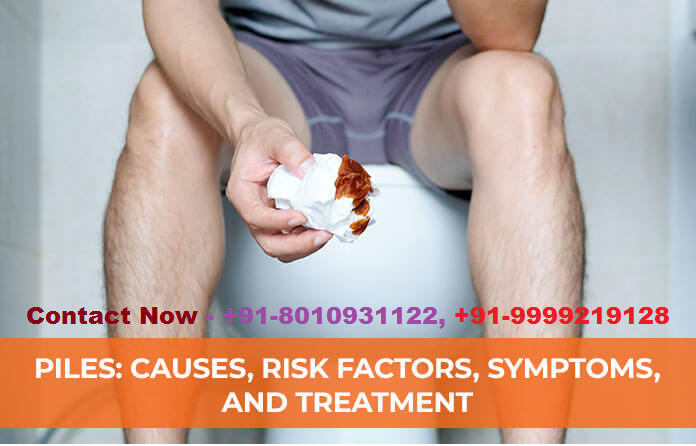 Piles treatment in delhi :: +91-8010931122