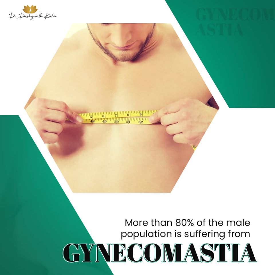 Gynecomastia Surgery in Hyderabad