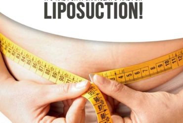 Liposuction Surgery in Hyderabad