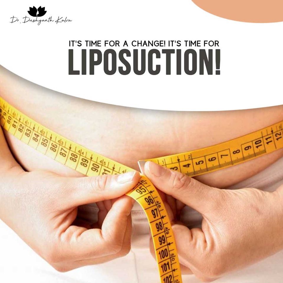 Liposuction Surgery in Hyderabad