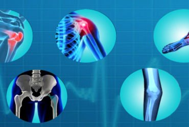 Sarvodaya Hospital – Best Orthopedic Hospital in Ghaziabad