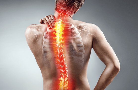 Kyphosis Correction in Hyderabad | Dr Surya Prakash Rao