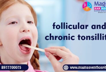 Follicular and chronic tonsillitis treatment in Hyderabad