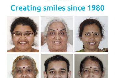 Cosmetic Dentistry treatment In Pune