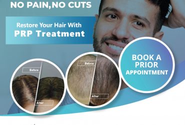 Hair Replantation in Kerala | Hair Growth Treatment in Kerala