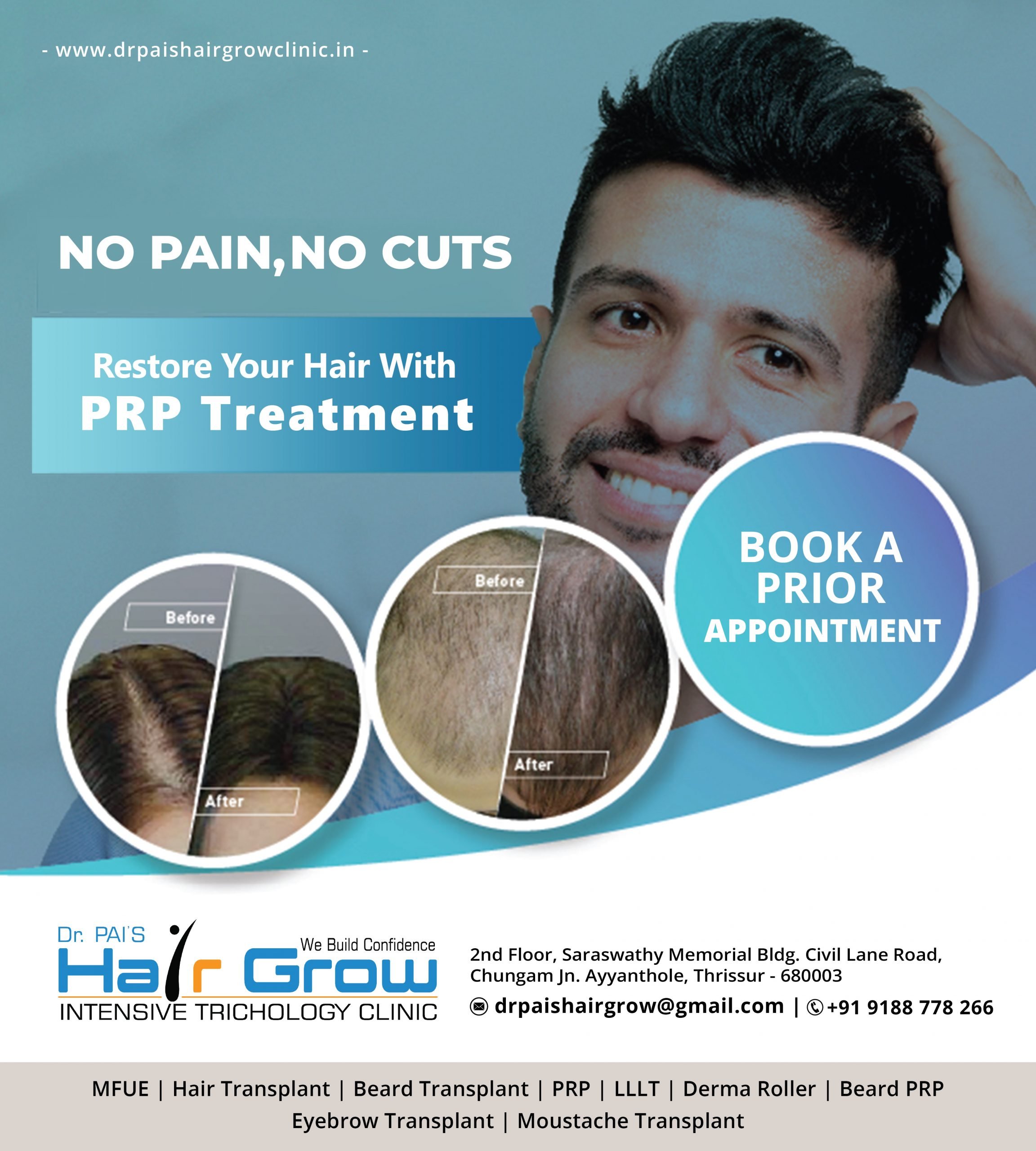 Hair Replantation in Kerala | Hair Growth Treatment in Kerala