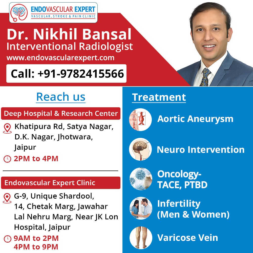 Varicose Veins effective treatment by Varicose veins Doctor in Jaipur |