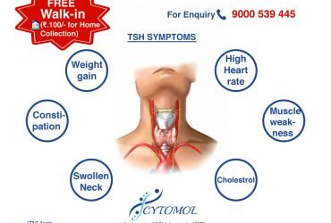 FREE THYROID TEST