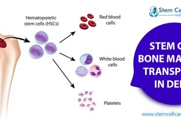 Private: Stem Cell Bone Marrow Transplant in Delhi