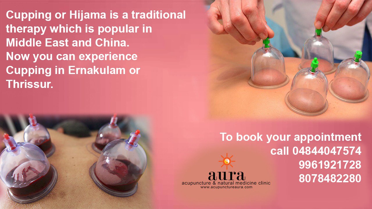 Hijama Cupping in Ernakulam and Thrissur