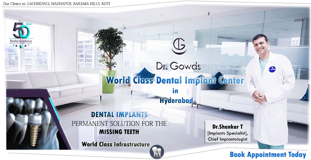 top dental hospital in Hyderabad