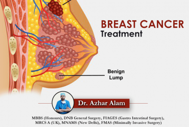 Best Breast Tumor Treatment In Kolkata | Dr. Azhar Alam