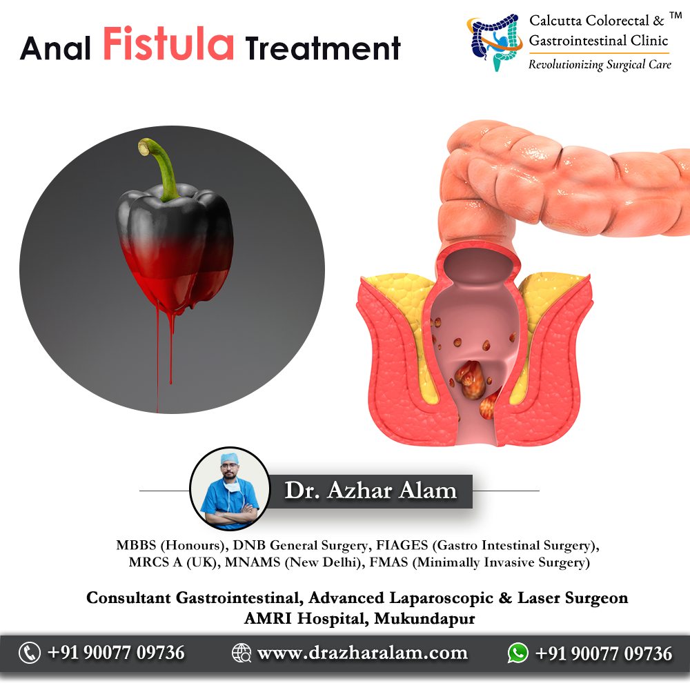 Private: Fistula Doctor in Kolkata | Best Treatment for Fistula