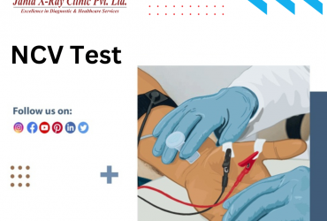 Private: NCV test in Delhi | NCV Test cost in Delhi