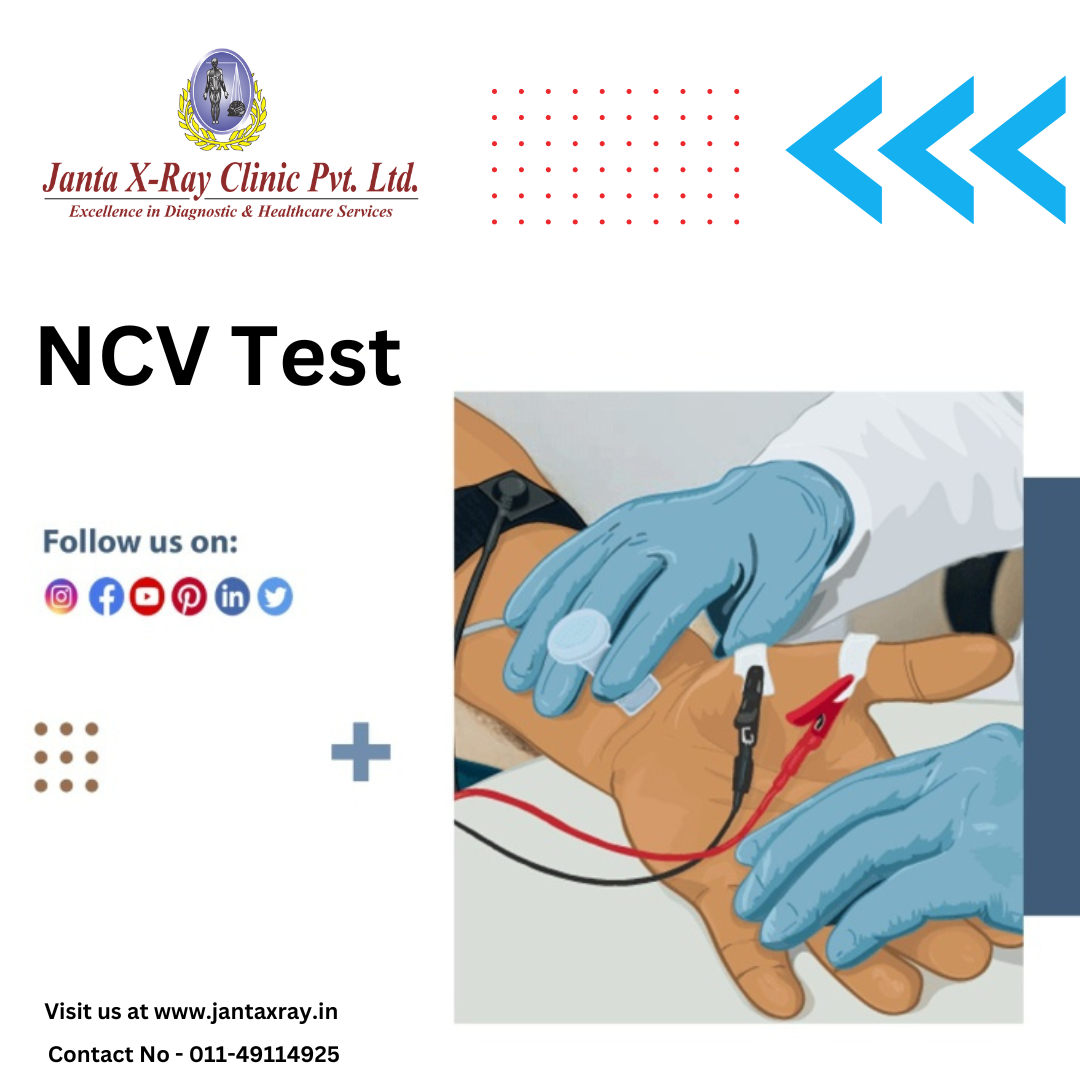 Private: NCV test in Delhi | NCV Test cost in Delhi