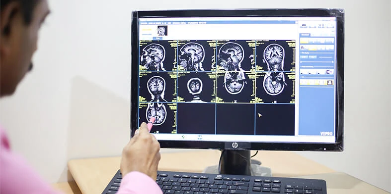 Stroke Hospital in Coimbatore