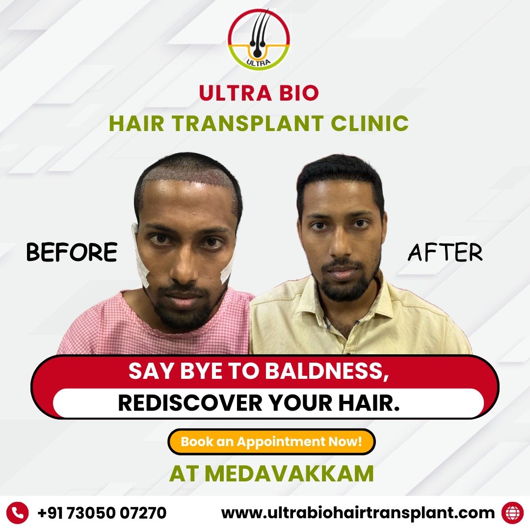 hair transplant clinic chennai